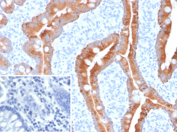 KRT18, KRT8 Antibody