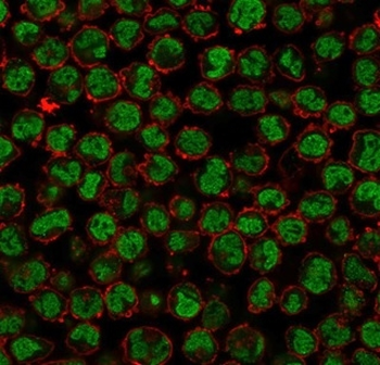 QKI Antibody