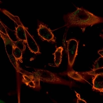 CBFB Antibody