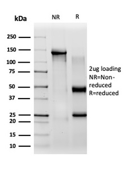 CBFB Antibody