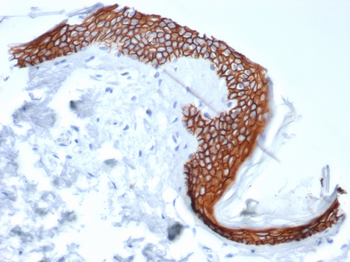 SDC1 Antibody