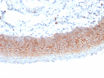 SDC1 Antibody