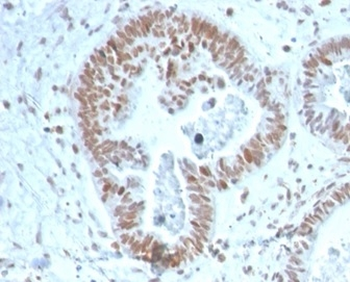 ZNF704 Antibody