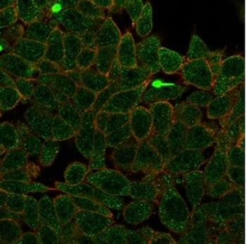 ZNF704 Antibody