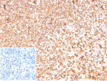 ACTB Antibody