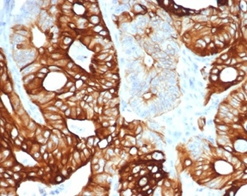 KRT20 Antibody