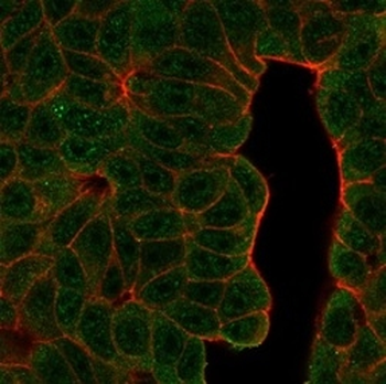 BCL11A Antibody