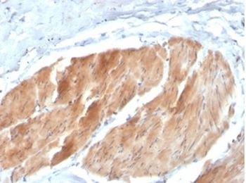 PIK3R2 Antibody
