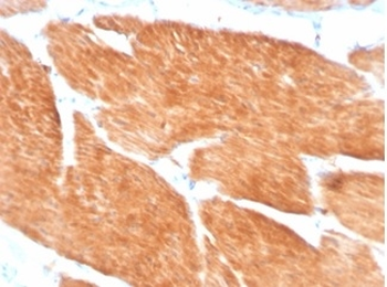 PIK3R2 Antibody