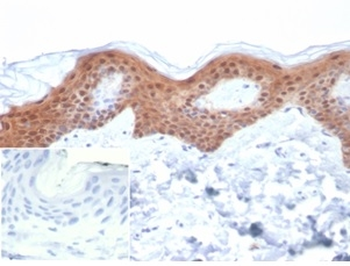 SERPINB5 Antibody
