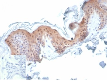 SERPINB5 Antibody