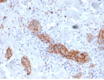 NGFR Antibody