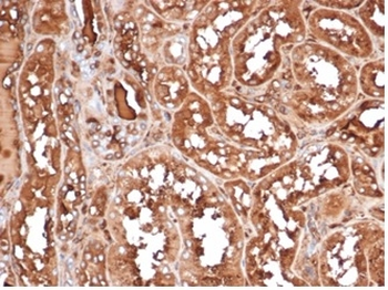 MICA Antibody