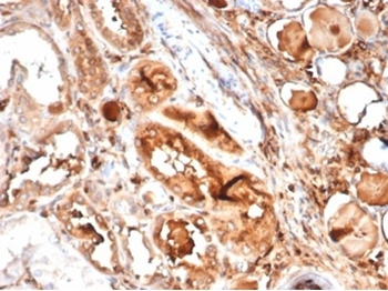 MICA Antibody