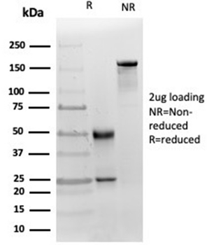 MICA Antibody