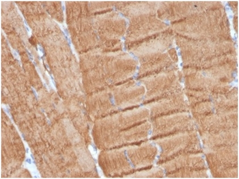 ACTA1 Antibody