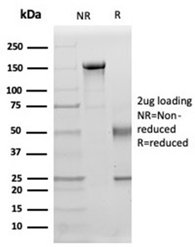 IL15 Antibody