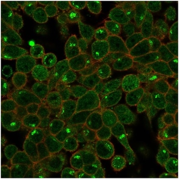 ZSCAN2 Antibody