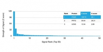 PGM5 Antibody