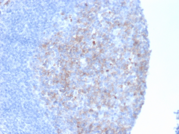 MME Antibody