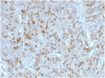 IL15 Antibody