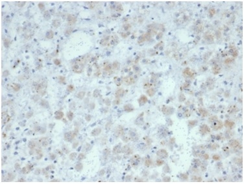 IL15 Antibody