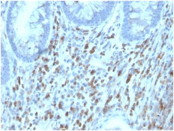 IL6ST Antibody