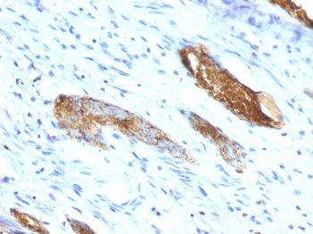 ABO Antibody
