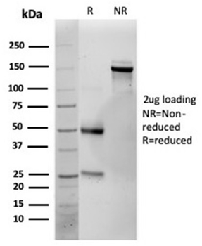 IL25 Antibody