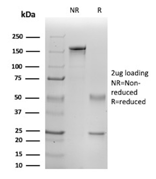 IL1B Antibody