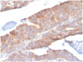 IL1B Antibody