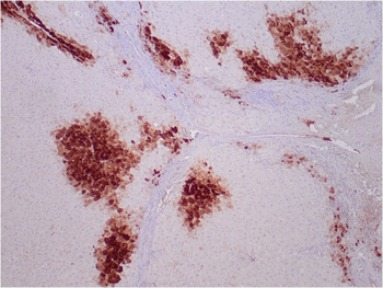 GLUL Antibody