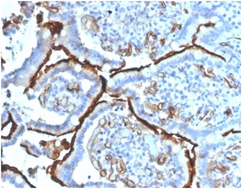 ACE Antibody