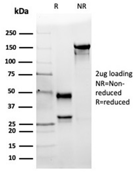 ACE Antibody
