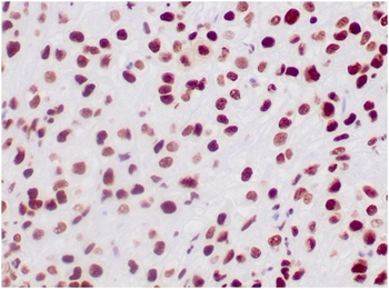 SMARCB1 Antibody