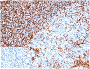 VIM Antibody