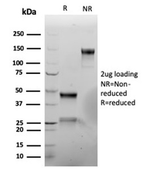 VIM Antibody