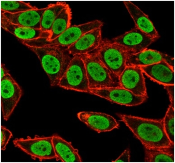 CHEK2 Antibody