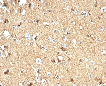 CKB Antibody