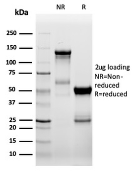 ZAP70 Antibody
