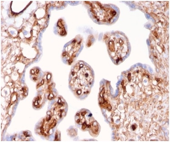 SPTAN1 Antibody