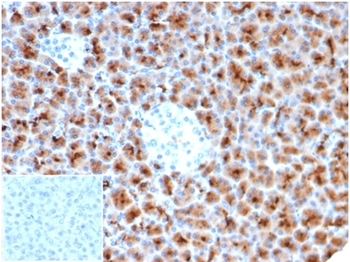 FSCN1 Antibody