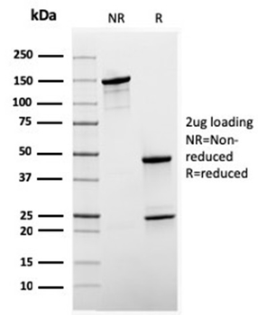 SHBG Antibody