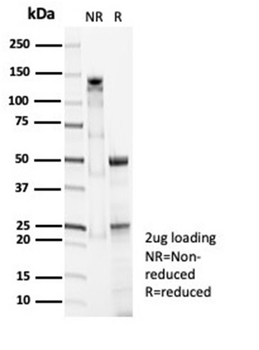 SFTPD Antibody