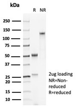 SFTPD Antibody