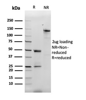 CCL8 Antibody