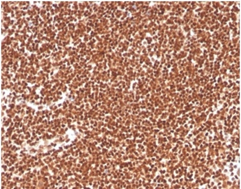 RPA2 Antibody