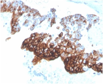KRT7 Antibody