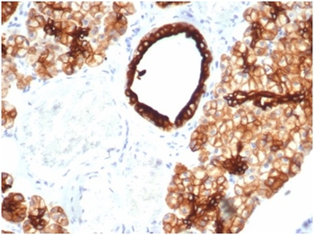 KRT7 Antibody