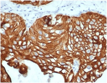 KRT7 Antibody